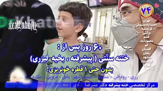 فیلم ختنه بدون بیهوشی