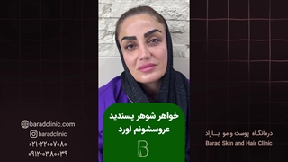 رضایت زیباجوی کاشت ابرو