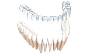 شماتیک الاینرتراپی