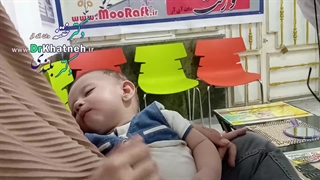 فیلم ختنه عالی نوزاد ۱۵ روز بعد