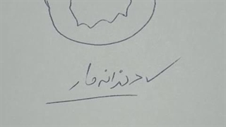 تفاوت بریدگی پرده بکارت سالم با پارگی