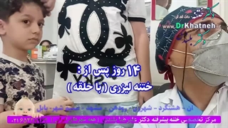 دکتر بلندی ختنه پیشرفته