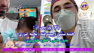 دکتر بلندی ختنه بدون درد