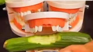 لمینت دندان ارسال به سراسر ایران