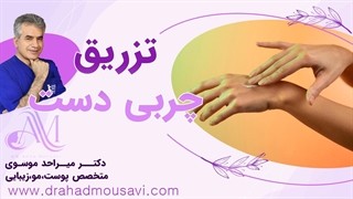 تزریق چربی دست چه مزایایی دارد دندانپزشک زیبایی