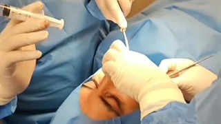 دندانپزشکی تحت بیهوشی در دندانپزشکی دکتر حمید پورصادقی