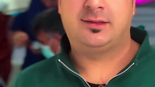 دکتر سیروس قاسمی لمینت