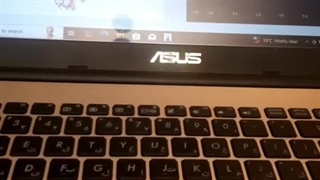 رضایت بیمار خانم حیدری مقدم با بیوفیلیا ، تهران