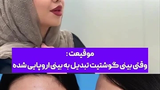 عمل بینی شیک و اروپایی در تهران