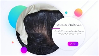 مطب دکتر معصومه نقدی در رشت هایفوتراپی