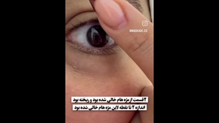 خواص و طرز استفاده از سرم تقویت مژه و ابرو لانبنا اورجینال