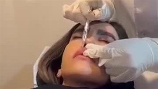 تزریق ژل لب بدون درد و کبودی | نکات حرفه‌ای