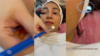 پاکسازی و فشیال پوست در مروارید آبی