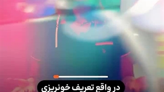 دکتر افسانه رستگار متخصص زنان ساری برداشتن توده