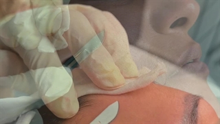 سمانه ابراهیمی پاکسازی پوست مشهد | سایت بهترین در مشهد