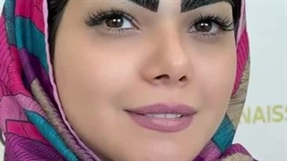 کاشت ابروی طبیعی در کلینیک زیبایی رنسانس