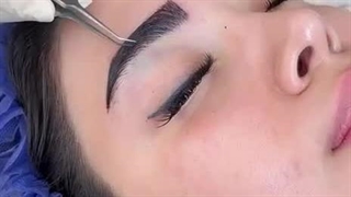 کاشت ابروی سوپر نچرال در کلینیک زیبایی رنسانس