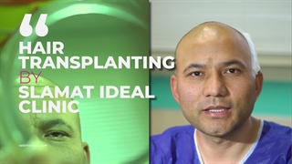 تجربه کاشت مو مشهد در کلینیک سلامت ایده آل