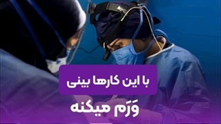 کاهش ورم بینی بعد از رینوپلاستی