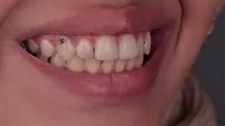 دکتر سمیرا زارع هایفوتراپی