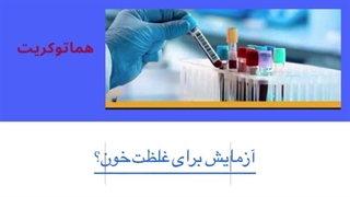 آیا غلظت خون باعث واریس می شود ؟