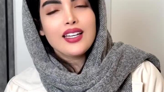 رضایت مراجعه کننده عزیز از کاشت ابرو در کلینیک رنسانس