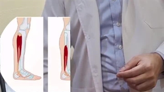 تقویت عضلات پا با دستگاه پزشکی Magnesia