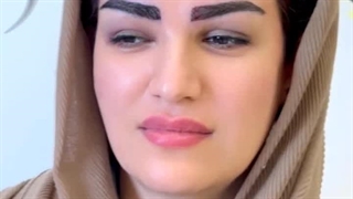 معجزه کاشت ابرو برای چهره ایی جذابتر