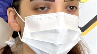 ابروهایی طبیعی ، پرپشت و ماندگار با کاشت ابرو