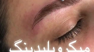 میکروبلیدینگ و فیبروز ابروها سالن زیبایی دلووان مشهد (2)