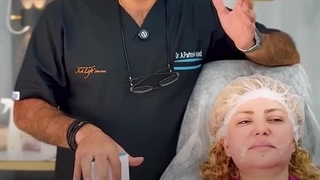 لیفت با نخ بهتر یا جراحی - دکتر علی پرتویی نژاد