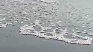 Part:8 عاشق دکتر بچه ام شده ام(اپلود مجدد)