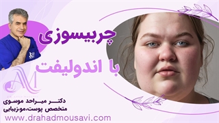 چربی سوزی و فرم‌دهی بدون درد با اندولیفت! راز یک بدن ایده‌آل