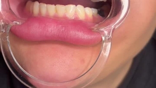 دندانپزشکی کرج ماهانا