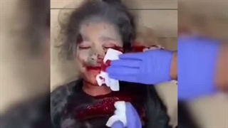 هشدار تصاویر دلخراش.  غزه .حمیده سعیدی