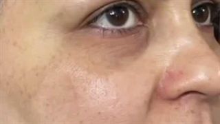 اگه میخوای مثل کره ای ها پوست شاداب داشته باشی