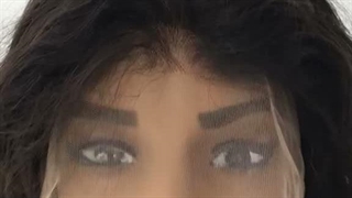 پروتز مو