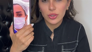 به روز ترین روش کاشت ابرو در کلینیک سینا
