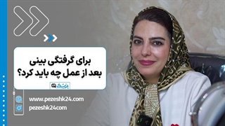 علت و درمان گرفتگی بینی بعد از عمل بینی - پزشک 24